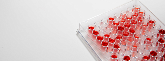 Болезнь в пробирке. Как можно воссоздать ревматоидный артрит и протестировать лекарства в лаборатории